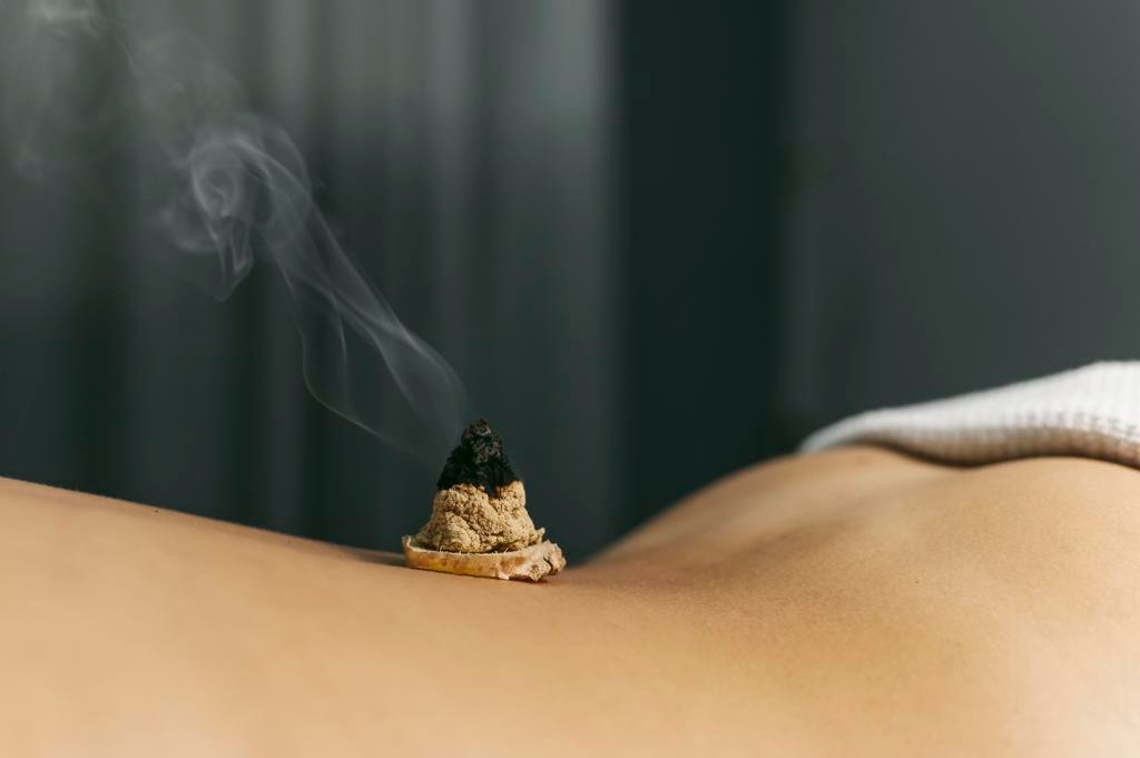 Moxa Therapy Moxa Therapy